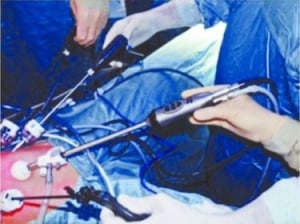 3D (Τρισδιάστατη) Λαπαροσκοπική Χειρουργική - Επέμβαση