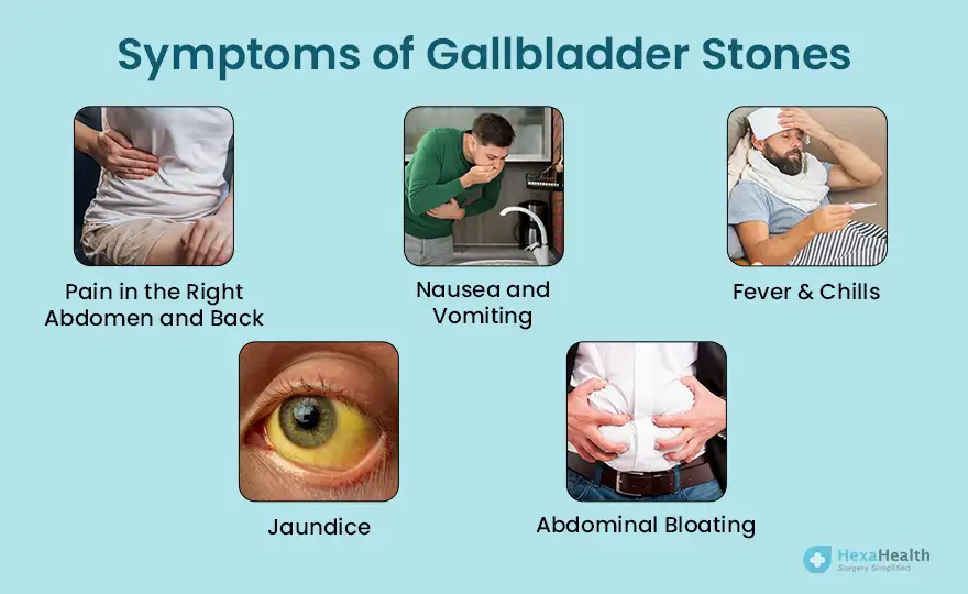 συμπτώματα χολικής λάσπης